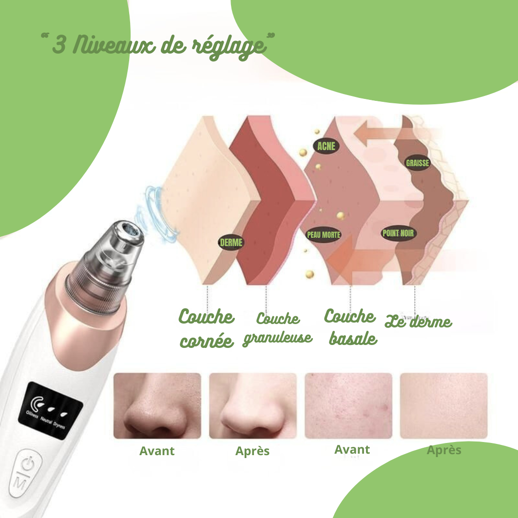Aspirateur nettoyeur de pores pour le visage