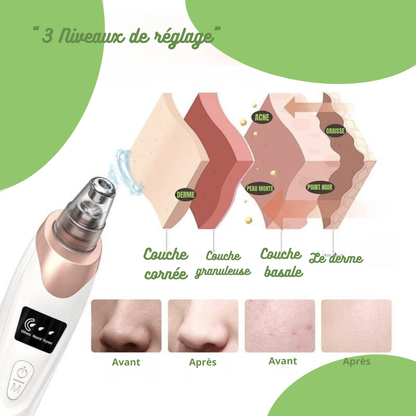 Aspirateur nettoyeur de pores pour le visage